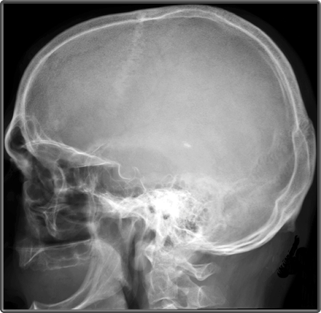 x ray skull anatomy
