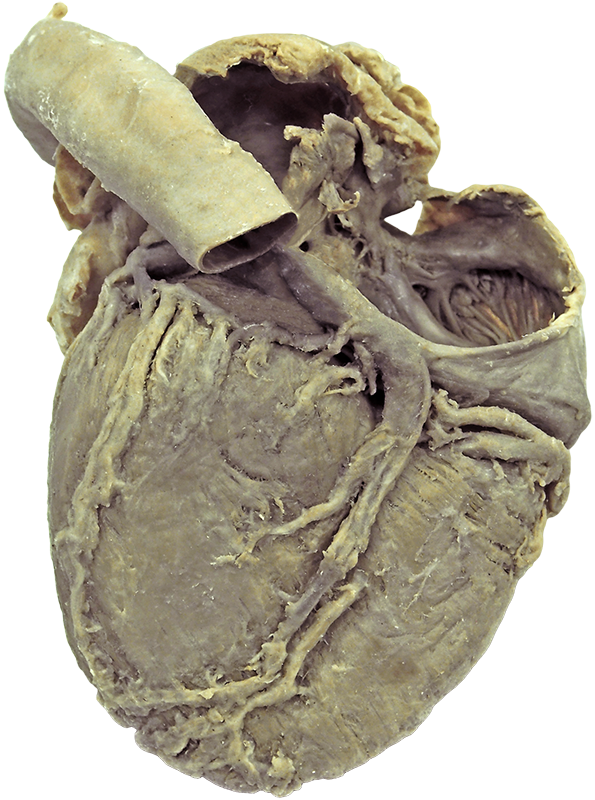 Clinical Anatomy | Atlas | Posterior Heart